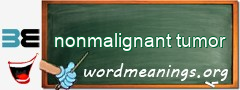 WordMeaning blackboard for nonmalignant tumor